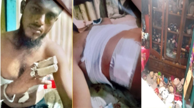 বন্দরে পূর্ব শত্রুতার জের ধরে আকিজ কোম্পানির শ্রমিককে কুপিয়ে রক্তাক্ত করেছে দুর্বৃত্তরা