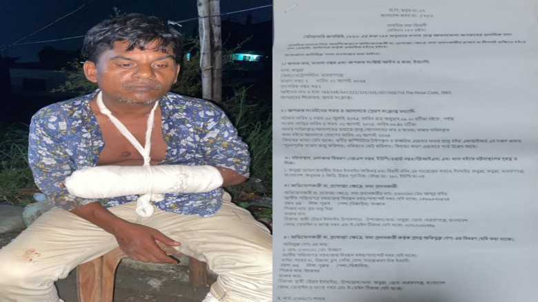 ইসদাইরে সংঘবদ্ধ হামলার অভিযোগে আটজনের বিরুদ্ধে হত্যা প্রচেষ্টার মামলা