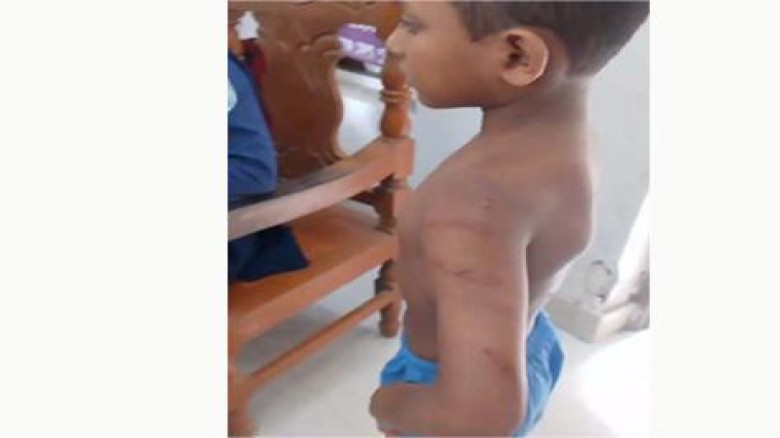 মাদ্রাসা ছাত্রকে বেত্রাঘাতে নির্যাতনের অভিযোগ উঠেছে শিক্ষকের বিরুদ্ধে