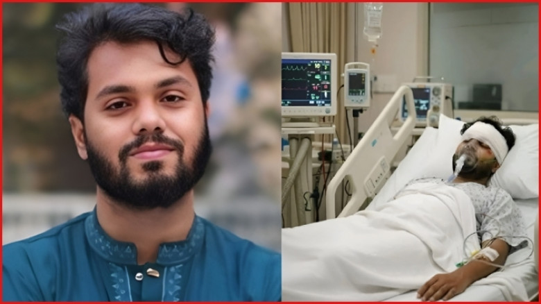 হাদির অবস্থা এখনও সংকটাপন্ন, ব্রেন সক্রিয় করতে প্রয়োজন অপারেশন