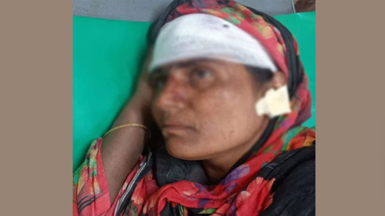 চরফ্যাশনে জামায়াত প্রার্থীর প্রচারণায় নামায় নারীর কান ছিঁড়ে মাথা ফাটালেন ও অন্তঃসত্ত্বা মেয়েকে মারধর করলেন যুবদল নেতা