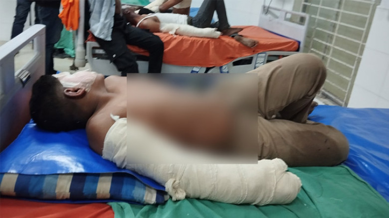 বিএনপির সমাবেশের আগে গ্যাস বেলুন বিস্ফোরণে দগ্ধ ১৮