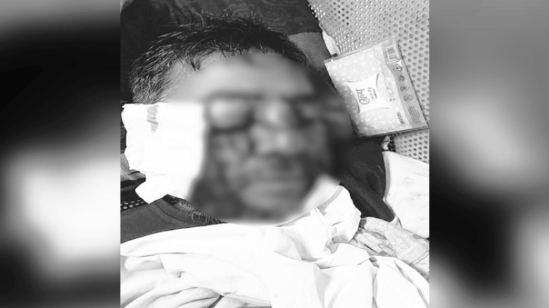 বগুড়ায় বিএনপি নেতার চোখ উপড়ে ফেলার অভিযোগ জামায়াতের বিরুদ্ধে