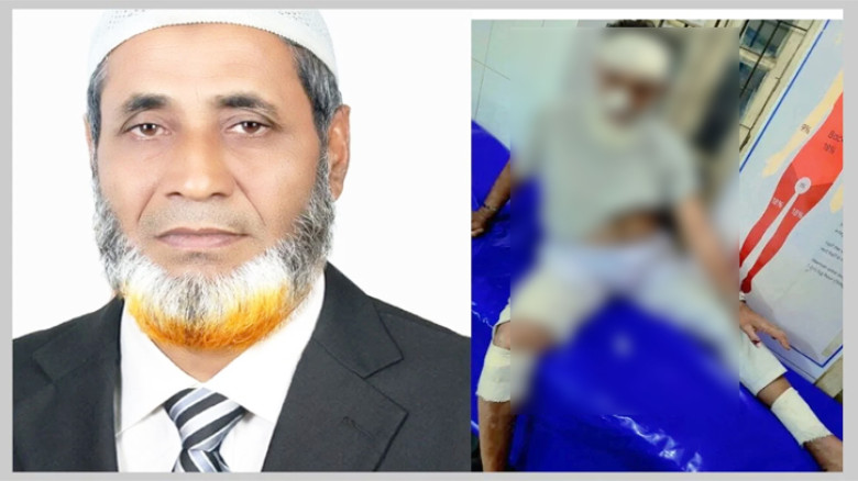জামায়াত ৪০ ভোটে জেতায় বিএনপি নেতাকে পিটিয়ে হাসপাতালে পাঠালেন কৃষকদল নেতা