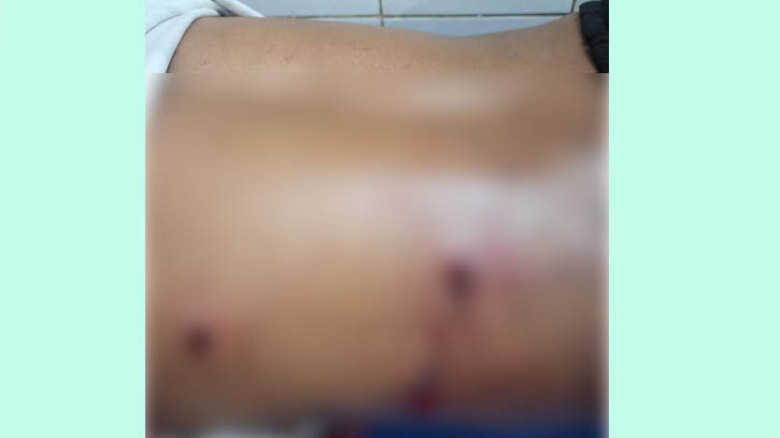 ব্রাহ্মণবাড়িয়ায় যুবক গুলিবিদ্ধ