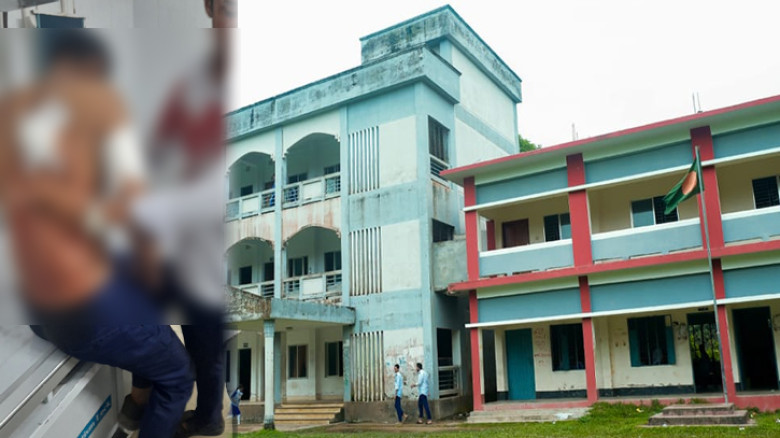 মোবাইল নিয়ে কথাকাটাকাটি, সহপাঠী ছুরিকাঘাতে নবম শ্রেণির শিক্ষার্থী আহত