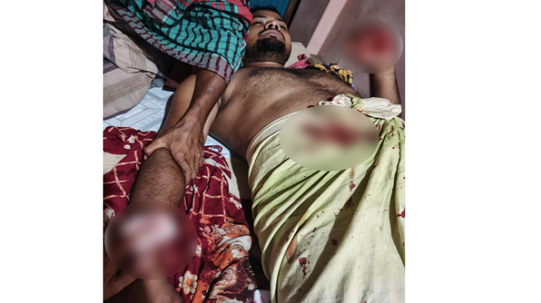 বোরহানউদ্দিনে চোরের হামলায় গৃহকর্তা আহত