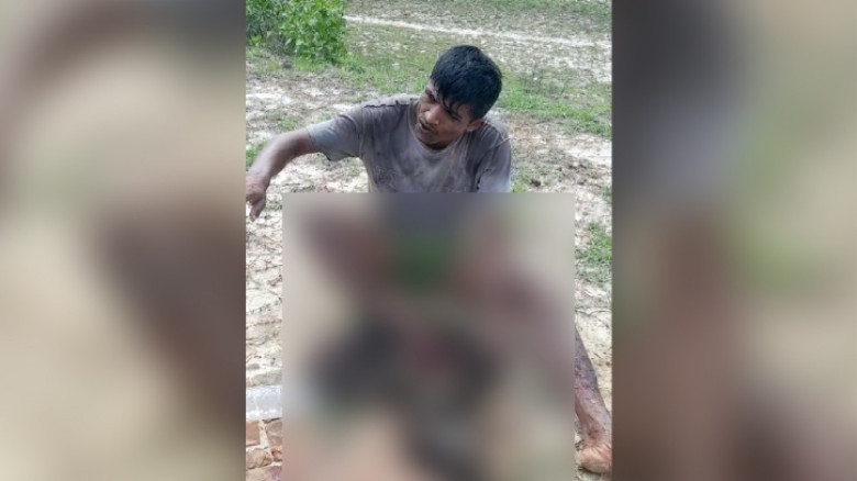 উখিয়া সীমান্তে স্থলমাইন বিস্ফোরণ: রোহিঙ্গা যুবকের পায়ের গোড়ালি বিচ্ছিন্ন