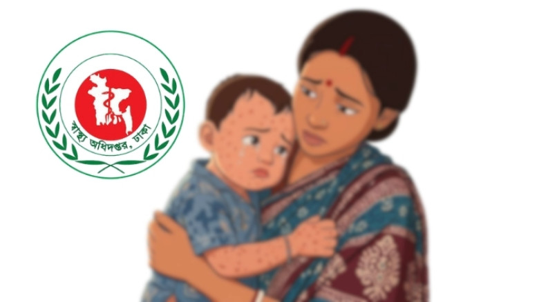 হাম ও হাম উপসর্গে আরও ১০ শিশুর মৃত্যু