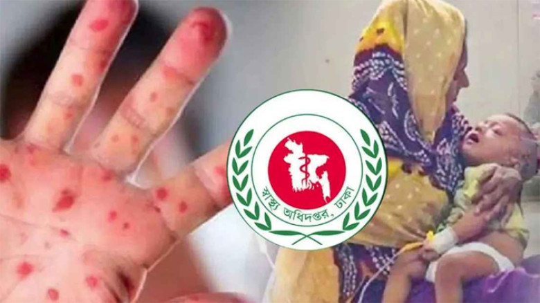 দেশে হাম ও উপসর্গে আরও ১০ শিশুর মৃত্যু