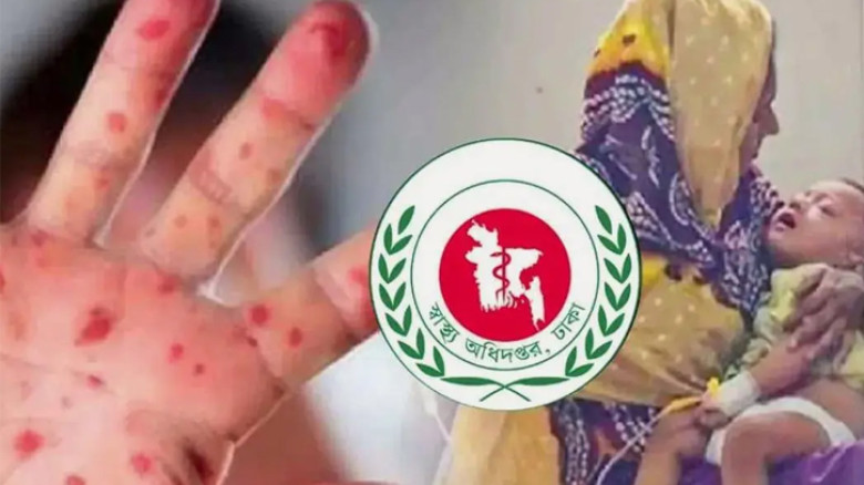 গত ২৪ ঘণ্টায় হাম ও উপসর্গে মারা গেল আরও ৪ জন, মৃত্যু বেড়ে ৬০৫