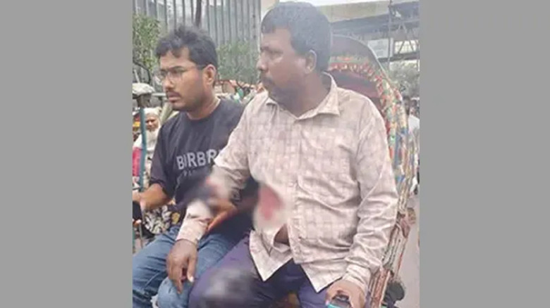 মতিঝিলে ব্যবসায়ীকে গুলি করে ১৭ হাজার ডলার ছিনতাই