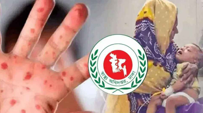 হাম ও হামের উপসর্গ নিয়ে গত ২৪ ঘণ্টায় আরও ৮ শিশুর মৃত্যু