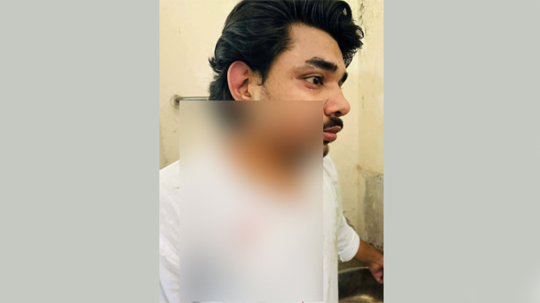 গাজীপুরে ছাত্রশক্তি নেতার ওপর হামলার অভিযোগ ছাত্রদল নেতাকর্মীদের বিরুদ্ধে