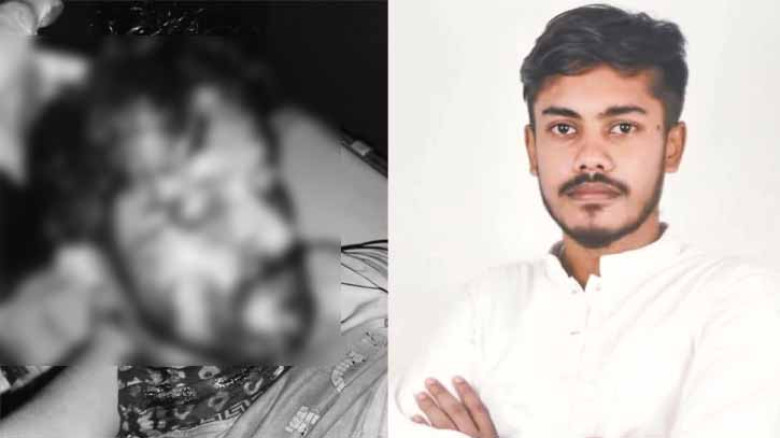 কেরানীগঞ্জে বিএনপি নেতার ছেলের হামলায় দর্জি গুরুতর আহত