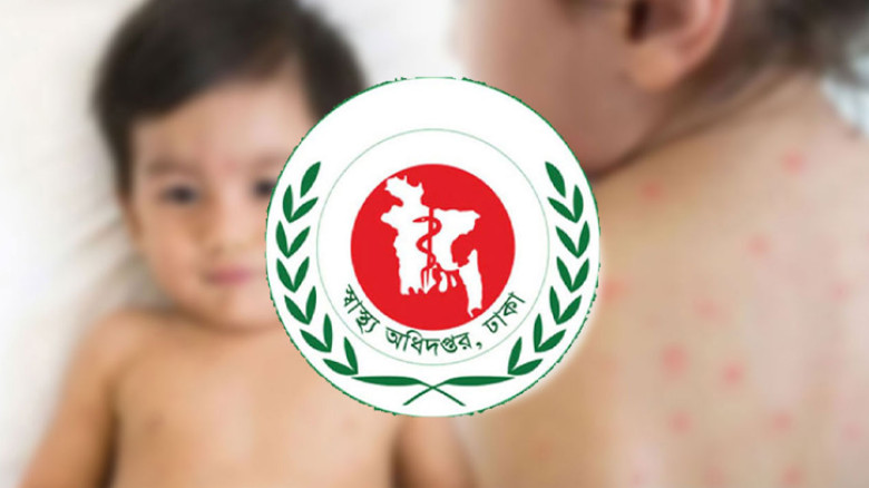দেশে হাম ও উপসর্গে আরও ৭ জনের মৃত্যু