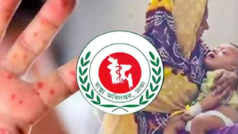 দেশে হামের উপসর্গে আরও ৪ মৃত্যু