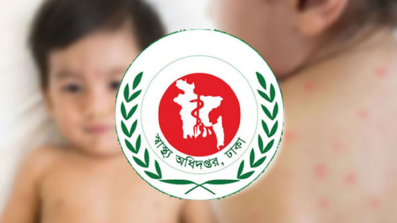 সারাদেশে হাম উপসর্গ নিয়ে আরও ৫ শিশুর মৃত্যু