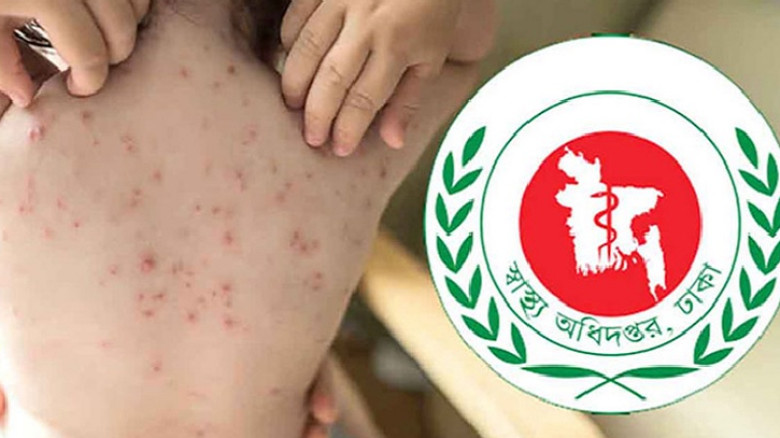 দেশে ২৪ ঘণ্টায় হাম উপসর্গে আরও ৪ শিশুর প্রাণহানি
