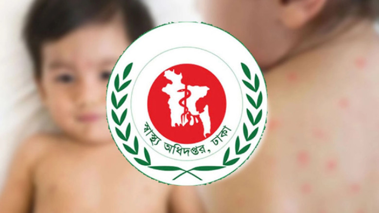 দেশে ২৪ ঘণ্টায় হাম উপসর্গে আরও ৬ জনের প্রাণহানি, মৃত্যু ছাড়ালো ৮০০