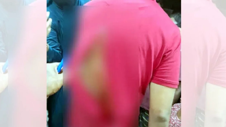 মোহাম্মদপুরে পুলিশের এসআইকে কুপিয়ে জখম, পিঠে ৪৩ সেলাই